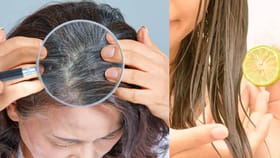 ನಿಂಬೆ ರಸ ಹಚ್ಚಿದ್ರೆ ಕೂದಲು ಬಿಳಿಯಾಗುತ್ತಾ?