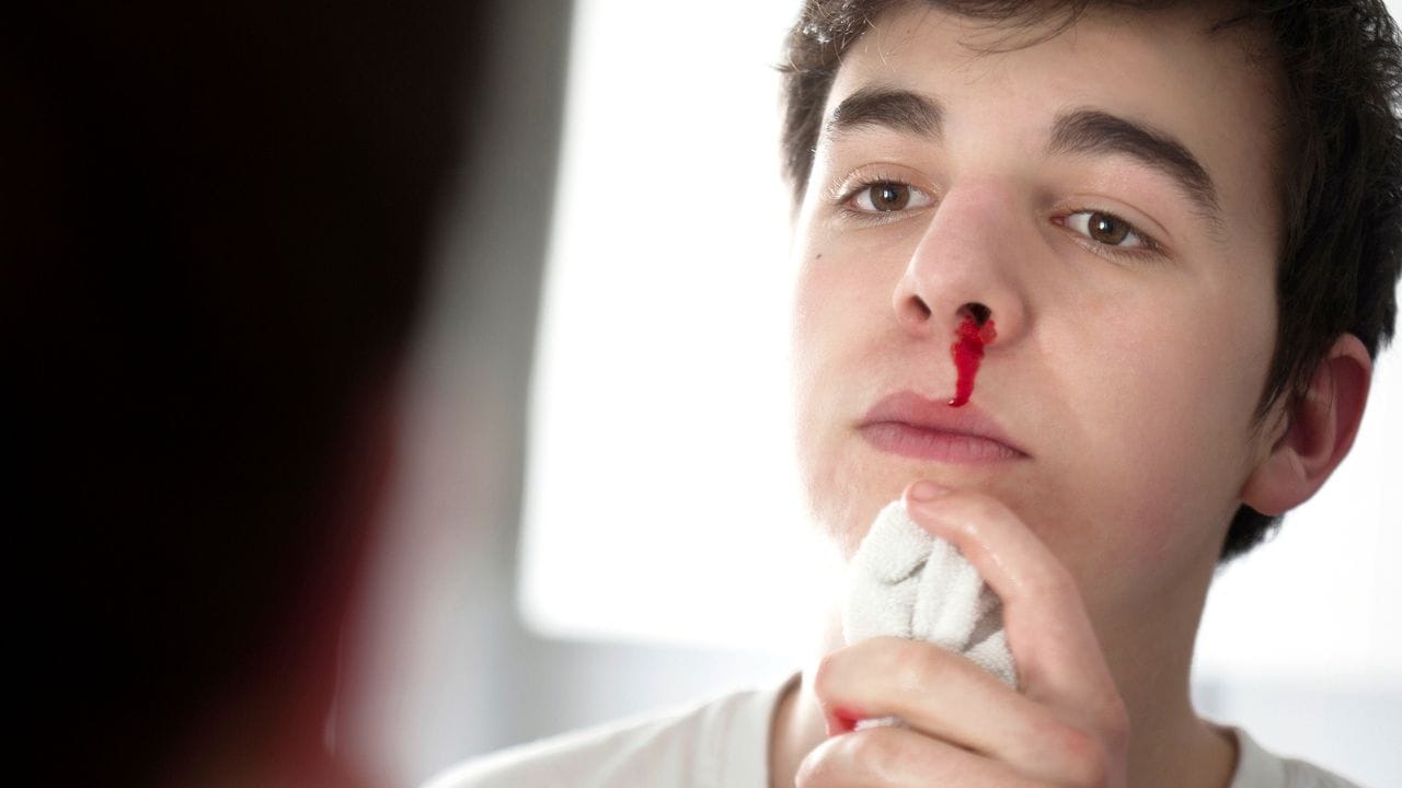 ಬೇಸಿಗೆಯಲ್ಲಿ ಮೂಗಿನಿಂದ ರಕ್ತಸ್ರಾವವಾಗುವುದಕ್ಕೆ ಕಾರಣ ಏನ್ ಗೊತ್ತಾ? ತಡೆಯಲು ತಕ್ಷಣ ಈ ರೀತಿ ಮಾಡಿ