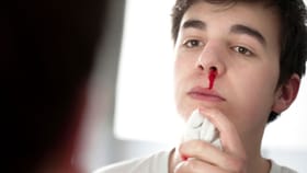 ಬೇಸಿಗೆಯಲ್ಲಿ ಮೂಗಿನಿಂದ ರಕ್ತಸ್ರಾವವಾದರೆ ಏನ್ ಮಾಡ್ಬೇಕು ಗೊತ್ತಾ?