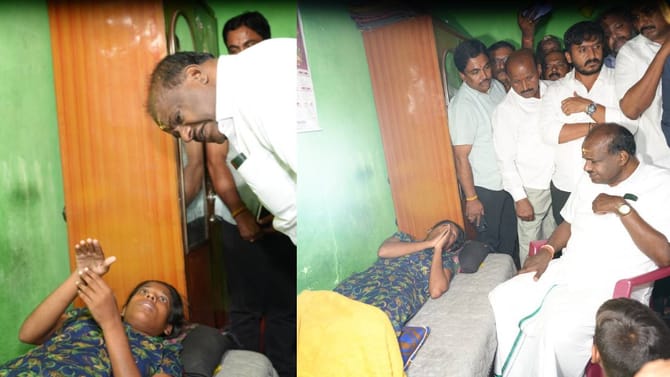 ಬರೋಬ್ಬರಿ 11 ಶಸ್ತ್ರಚಿಕಿತ್ಸೆ: ಯುವತಿ ಸ್ಥಿತಿ ಕಂಡು ಮರುಗಿದ ಕುಮಾರಸ್ವಾಮಿ