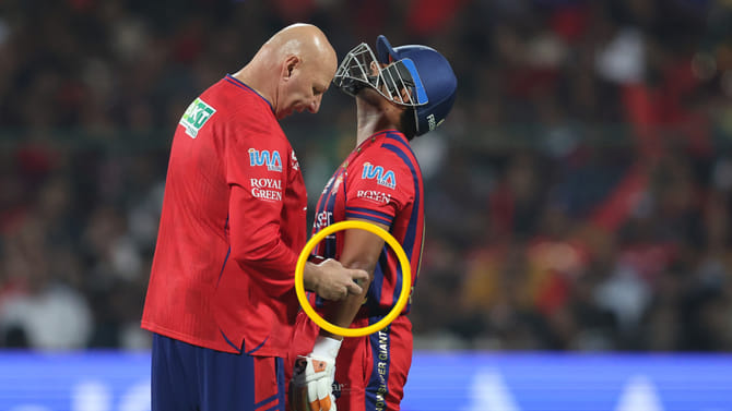 ರಿಷಭ್ ಪಂತ್ ಮೊಣಕೈಗೆ ಗಂಭೀರ ಗಾಯ