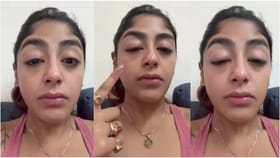 ರಿಯಾಲಿಟಿ ಶೋ ಸ್ಪರ್ಧಿ ಮೇಲೆ ಹಲ್ಲೆ; ಕಣ್ಣು ಊದೋಯ್ತು, ಹಲ್ಲು ಮುರಿದೋಯ್ತು