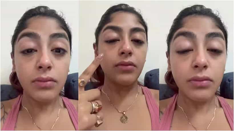 ರಿಯಾಲಿಟಿ ಶೋ ಸ್ಪರ್ಧಿ ಮೇಲೆ ಹಲ್ಲೆ; ಕಣ್ಣು ಊದೋಯ್ತು, ಹಲ್ಲು ಮುರಿದೋಯ್ತು