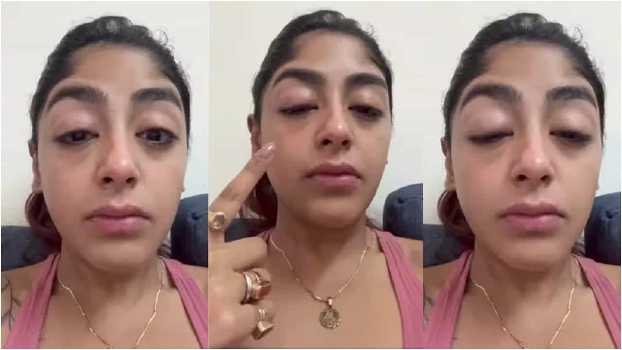 ರಿಯಾಲಿಟಿ ಶೋ ಸ್ಪರ್ಧಿ ಮೇಲೆ ಹಲ್ಲೆ; ಕಣ್ಣು ಊದೋಯ್ತು, ಹಲ್ಲು ಮುರಿದೋಯ್ತು