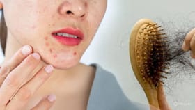 ಹೆಚ್ಚು ಸ್ಟ್ರೆಸ್‌ ಮಾಡಿಕೊಂಡರೆ ಕೂದಲು ಉದುರಿ ಚರ್ಮದ ಅಂದ ಹಾಳಾಗುತ್ತಾ?