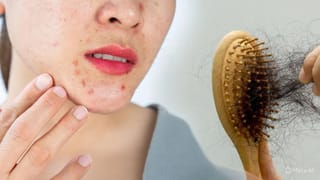 ಭಾರತೀಯ ವಿವಾಹಗಳಲ್ಲಿ ಹೊಸ ಟ್ರೆಂಡ್: 13 ರಿಂದ 25 ಸಾವಿರ ರೂ. ಬೆಲೆಯ ಇಂಜೆಕ್ಷನ್ ತಗೊಳ್ತಿದ್ದಾರೆ ವಧುಗಳು!