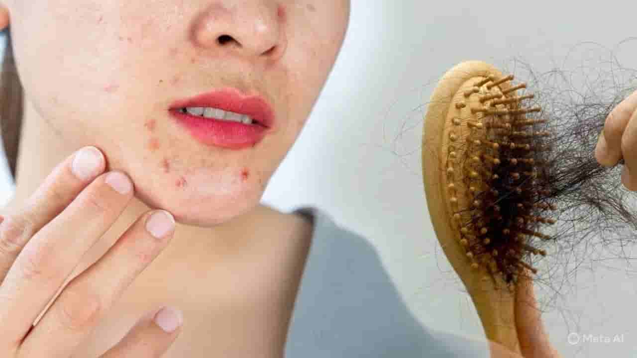 ಹೆಚ್ಚು ಸ್ಟ್ರೆಸ್ ಮಾಡಿಕೊಂಡರೆ ಕೂದಲು, ಚರ್ಮಕ್ಕೆ ಸಂಬಂಧಿಸಿದ ಸಮಸ್ಯೆಗಳು ಬರುತ್ತವೆಯೇ?