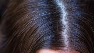 ಬಿಸಿಲಿಗೆ ಹೋದ ತಕ್ಷಣ ತಲೆನೋವು ಬರುತ್ತಾ? ಹಾಗಿದ್ರೆ ನಿಮಗೆ ಈ ಸಮಸ್ಯೆ ಇದೆ ಎಂದರ್ಥ!