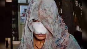 ಪತ್ನಿ ಜತೆ ಜಗಳವಾಡಿ ಆಕೆಯ ಮೂಗು, ಕೆನ್ನೆ ಕಚ್ಚಿದ ವ್ಯಕ್ತಿ