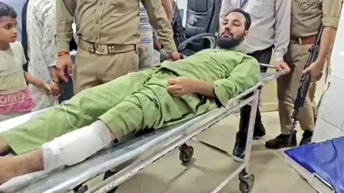 ಬುರ್ಖಾ ಧರಿಸಿದ್ದ ಮಹಿಳೆಯ ಮೈಮುಟ್ಟಿ ಪರಾರಿಯಾಗಿದ್ದವನಿಗೆ ಗುಂಡೇಟು