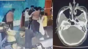 ಭುಜ ಟಚ್​​ ಆಗಿದ್ದಕ್ಕೆ ಯುವಕನ ತಲೆ ಜಜ್ಜಿದ ಕಿರಾತಕ!