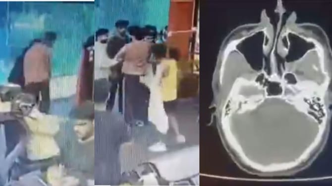 ಭುಜ ಟಚ್​​ ಆಗಿದ್ದಕ್ಕೆ ಯುವಕನ ತಲೆ ಜಜ್ಜಿದ ಕಿರಾತಕ!
