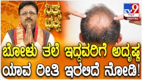 ಬೋಳು ತಲೆಯಿದ್ದವರಿಗೆ ಅದೃಷ್ಟವೋ ಅದೃಷ್ಟ! ಯಾಕೆ ಗೊತ್ತಾ?
