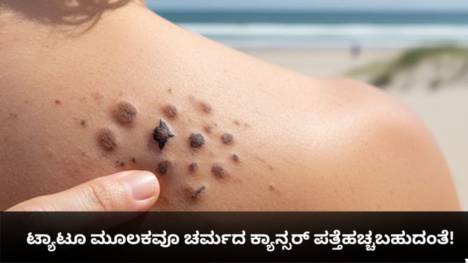 ಟ್ಯಾಟೂ ಮೂಲಕವೂ ಚರ್ಮದ ಕ್ಯಾನ್ಸರ್ ಪತ್ತೆಹಚ್ಚಬಹುದಂತೆ!