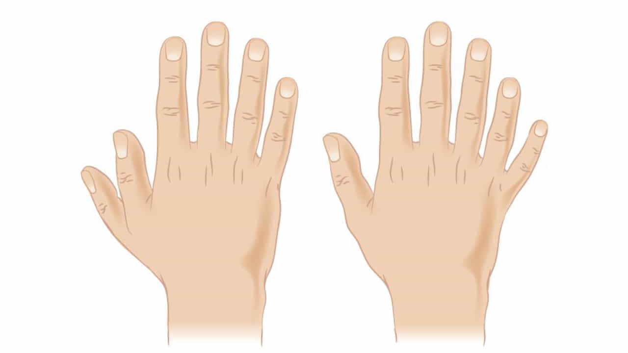 Palmistry: ಕೈಯಲ್ಲಿ ಆರು ಬೆರಳುಗಳಿದ್ದರೆ ಅದೃಷ್ಟವೇ? ಹಸ್ತಸಾಮುದ್ರಿಕ ಶಾಸ್ತ್ರ ಹೇಳುವುದೇನು?