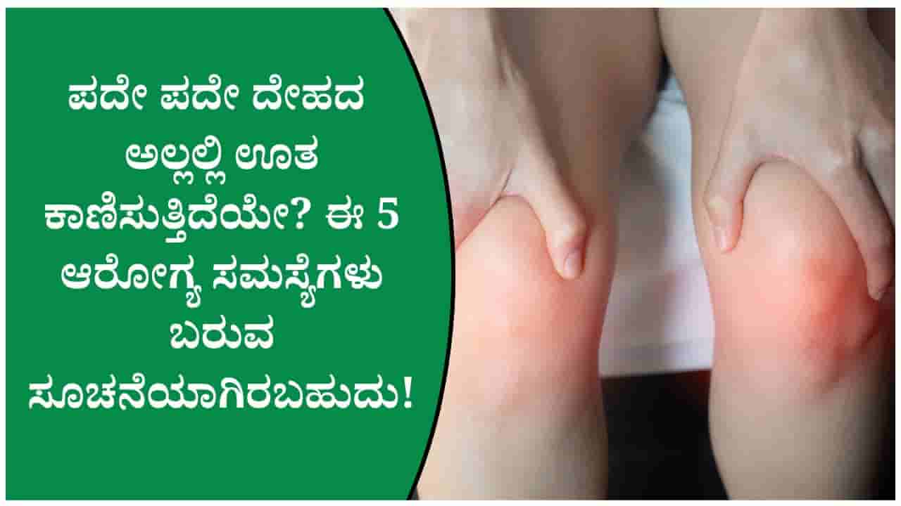 ದೇಹದ ಅಲ್ಲಲ್ಲಿ ಊತ ಕಾಣಿಸಿಕೊಳ್ಳುವುದು ಈ ಆರೋಗ್ಯ ಸಮಸ್ಯೆ ಬರುವ ಸೂಚನೆಯಾಗಿರಬಹುದು!