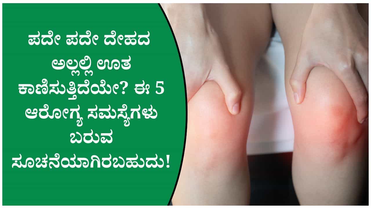 ದೇಹದ ಅಲ್ಲಲ್ಲಿ ಊತ ಕಾಣಿಸಿಕೊಳ್ಳುವುದು ಈ ಆರೋಗ್ಯ ಸಮಸ್ಯೆ ಬರುವ ಸೂಚನೆಯಾಗಿರಬಹುದು! ದೇಹದ ಅಲ್ಲಲ್ಲಿ ಊತ ಕಾಣಿಸಿಕೊಳ್ಳುವುದು ಈ ಆರೋಗ್ಯ ಸಮಸ್ಯೆ ಬರುವ ಸೂಚನೆಯಾಗಿರಬಹುದು!