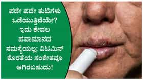 ಪದೇ ಪದೇ ತುಟಿ ಒಡೆಯುವುದನ್ನು ತಡೆಯಲು ಈ ರೀತಿ ಮಾಡಿ
