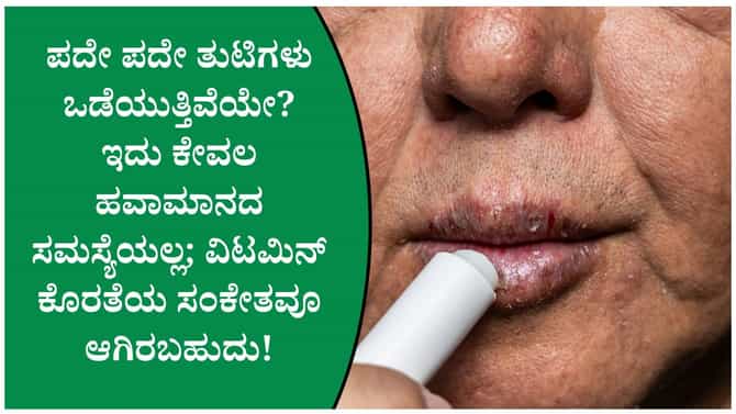 ಪದೇ ಪದೇ ತುಟಿ ಒಡೆಯುವುದನ್ನು ತಡೆಯಲು ಈ ರೀತಿ ಮಾಡಿ