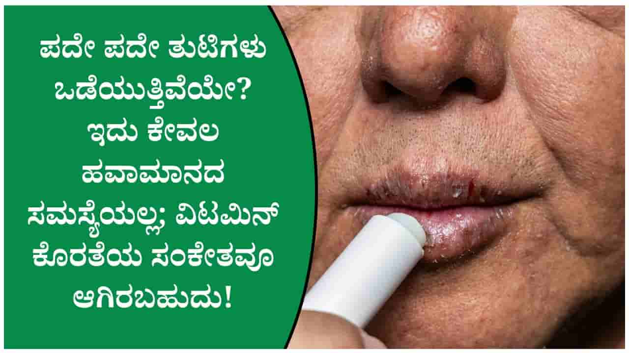 ಪದೇ ಪದೇ ತುಟಿ ಒಡೆಯುವುದು ಕೇವಲ ಹವಾಮಾನದಿಂದಲ್ಲ ಇದಕ್ಕೆ ಈ ವಿಟಮಿನ್ ಕೊರತೆಯೂ ಕಾರಣವಾಗಿರಬಹುದು