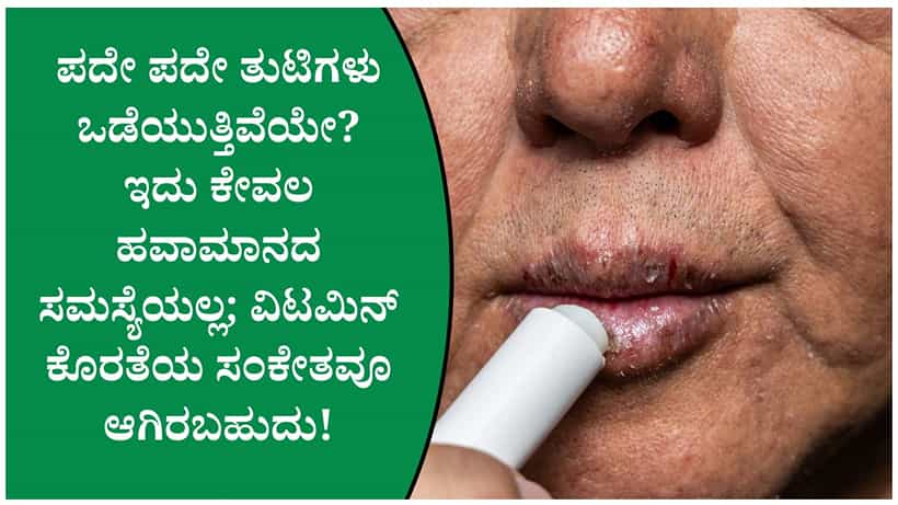 ಪದೇ ಪದೇ ತುಟಿ ಒಡೆಯುವುದು ಕೇವಲ ಹವಾಮಾನದಿಂದಲ್ಲ ಇದಕ್ಕೆ ಈ ವಿಟಮಿನ್ ಕೊರತೆಯೂ ಕಾರಣವಾಗಿರಬಹುದು