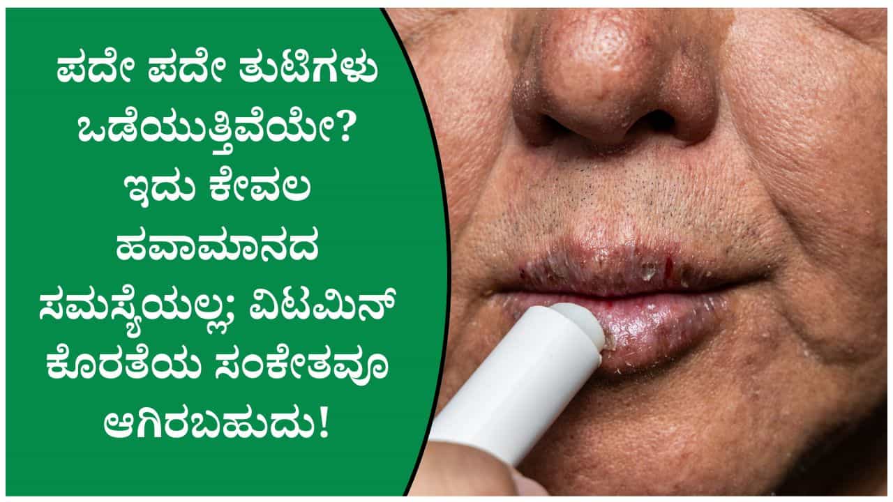 ಪದೇ ಪದೇ ತುಟಿ ಒಡೆಯುವುದು ಕೇವಲ ಹವಾಮಾನದಿಂದಲ್ಲ ಇದಕ್ಕೆ ಈ ವಿಟಮಿನ್ ಕೊರತೆಯೂ ಕಾರಣವಾಗಿರಬಹುದು ಪದೇ ಪದೇ ತುಟಿ ಒಡೆಯುವುದು ಕೇವಲ ಹವಾಮಾನದಿಂದಲ್ಲ ಇದಕ್ಕೆ ಈ ವಿಟಮಿನ್ ಕೊರತೆಯೂ ಕಾರಣವಾಗಿರಬಹುದು