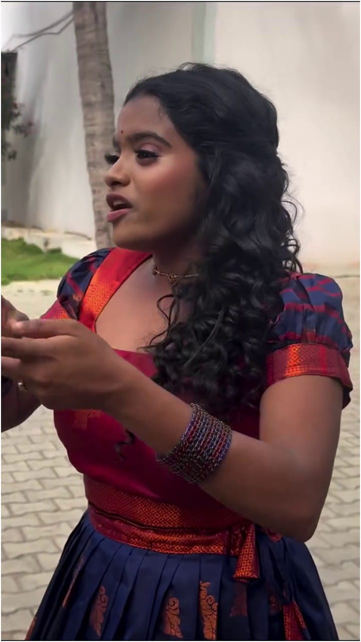ಓವರ್​ ಆ್ಯಕ್ಟಿಂಗ್ ಮಾಡ್ತೀನಿ ಅನ್ನೋದು ಒಪ್ಪಿಕೊಂಡ ರಕ್ಷಿತಾ ಶೆಟ್ಟಿ