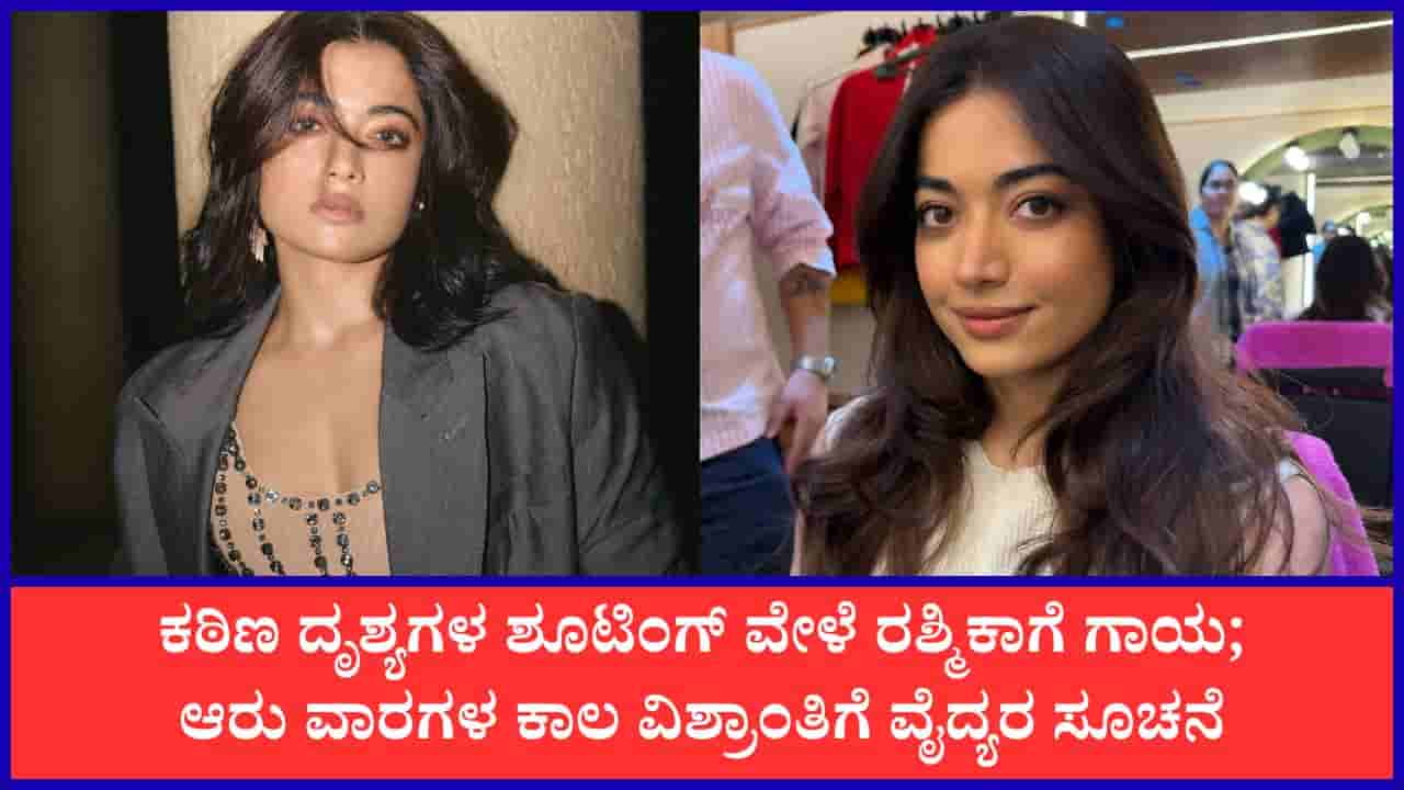 ನಟಿ ರಶ್ಮಿಕಾ ಮಂದಣ್ಣಗೆ ಗಂಭೀರ ಗಾಯ: ಮುಂದಿನ 6 ವಾರಗಳ ಕಾಲ ವಿಶ್ರಾಂತಿ ಅಗತ್ಯ
