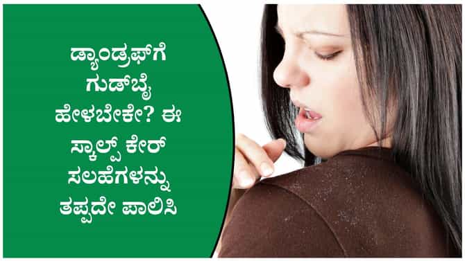 ಡ್ಯಾಂಡ್ರಫ್‌ಗೆ ಗುಡ್‌ಬೈ ಹೇಳಬೇಕೇ? ಈ ಸ್ಕಾಲ್ಪ್ ಕೇರ್ ಪಾಲಿಸಿ