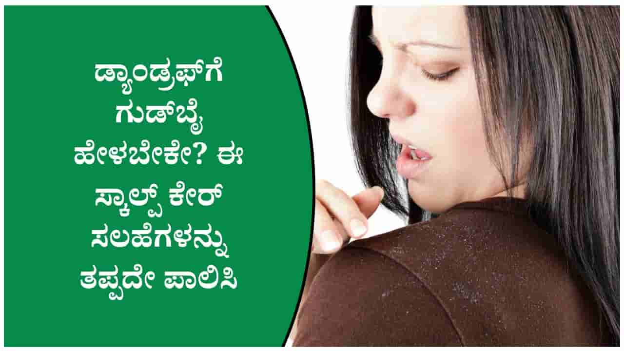 ತಲೆಹೊಟ್ಟಿನ ಸಮಸ್ಯೆಯನ್ನು ನಿರ್ಲಕ್ಷಿಸಬೇಡಿ! ಈ ಅಭ್ಯಾಸಗಳು ಸಮಸ್ಯೆಯನ್ನು ಹೆಚ್ಚಿಸಬಹುದು