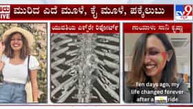 ಬೆಂಗಳೂರಲ್ಲಿ ರ್‍ಯಾಪಿಡೋ ಚಾಲಕನ ಎಡವಟ್ಟಿನಿಂದ ಆಸ್ಪತ್ರೆ ಸೇರಿದ ಯುವತಿ, ಆಗಿದ್ದೇನು?