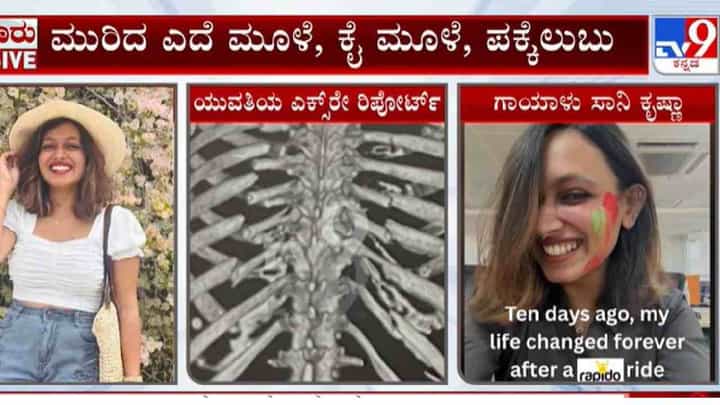 ಬೆಂಗಳೂರಲ್ಲಿ ರ್ಯಾಪಿಡೋ ಚಾಲಕನ ಎಡವಟ್ಟಿನಿಂದ ಆಸ್ಪತ್ರೆ ಸೇರಿದ ಯುವತಿ, ಆಗಿದ್ದೇನು? ಬೆಂಗಳೂರಲ್ಲಿ ರ್ಯಾಪಿಡೋ ಚಾಲಕನ ಎಡವಟ್ಟಿನಿಂದ ಆಸ್ಪತ್ರೆ ಸೇರಿದ ಯುವತಿ, ಆಗಿದ್ದೇನು?