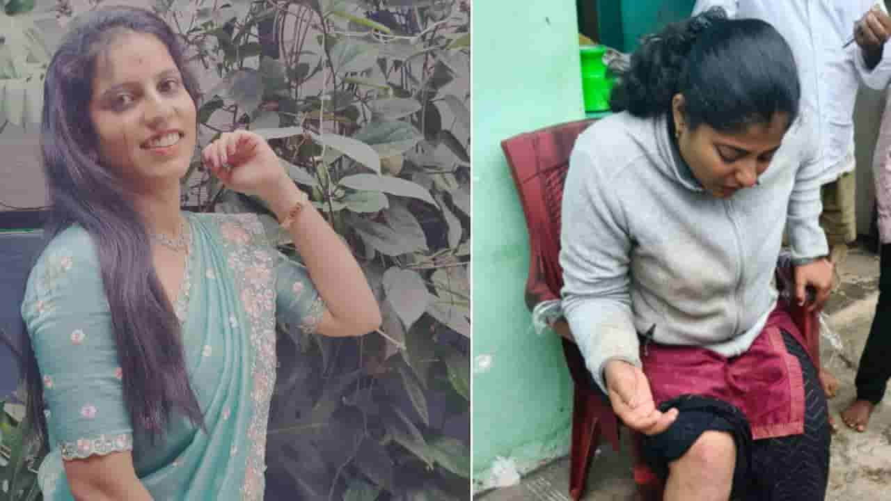 ತುಮಕೂರು: SIR ಕರ್ತವ್ಯಕ್ಕೆ ತೆರಳುತ್ತಿದ್ದಾಗ ಅಪಘಾತ; ಇಬ್ಬರು ಮಹಿಳಾ ಸಿಬ್ಬಂದಿ ಪೈಕಿ ಓರ್ವರ ಸ್ಥಿತಿ ಗಂಭೀರ