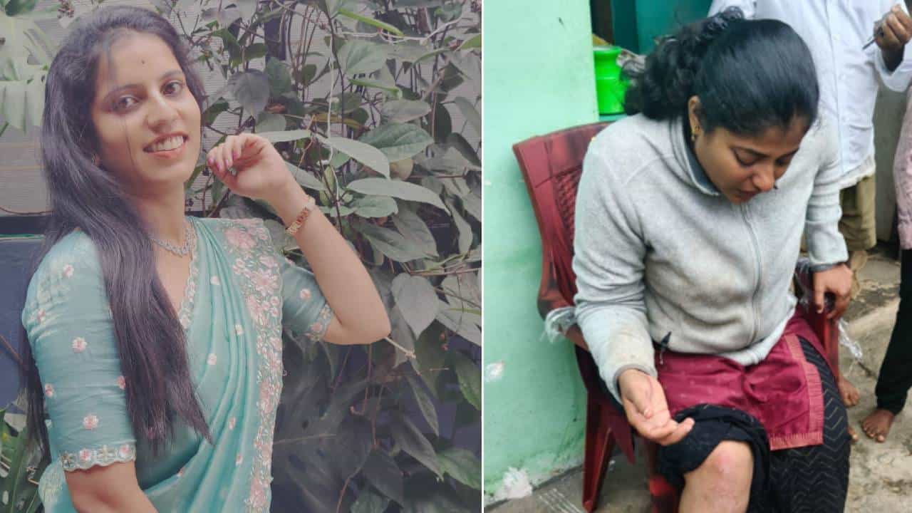 ತುಮಕೂರು: SIR ಕರ್ತವ್ಯಕ್ಕೆ ತೆರಳುತ್ತಿದ್ದಾಗ ಅಪಘಾತ; ಇಬ್ಬರು ಮಹಿಳಾ ಸಿಬ್ಬಂದಿ ಪೈಕಿ ಓರ್ವರ ಸ್ಥಿತಿ ಗಂಭೀರ ತುಮಕೂರು: SIR ಕರ್ತವ್ಯಕ್ಕೆ ತೆರಳುತ್ತಿದ್ದಾಗ ಅಪಘಾತ; ಇಬ್ಬರು ಮಹಿಳಾ ಸಿಬ್ಬಂದಿ ಪೈಕಿ ಓರ್ವರ ಸ್ಥಿತಿ ಗಂಭೀರ