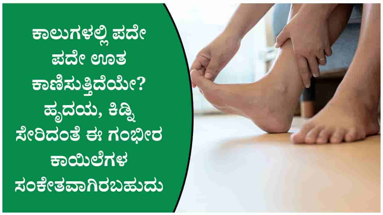 ಕಾಲುಗಳಲ್ಲಿ ಮತ್ತೆ ಮತ್ತೆ ಊತ ಕಾಣಿಸುತ್ತಿದೆಯೇ? ಇದು ಕೆಲವು ಆರೋಗ್ಯ ಸಮಸ್ಯೆಯ ಸಂಕೇತವಾಗಿರಬಹುದು!