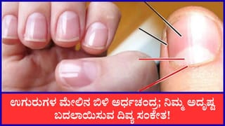 Samudrika Shastra: ನಿಮ್ಮ ಉಗುರುಗಳ ಮೇಲೆ  ಬಿಳಿ ಅರ್ಧಚಂದ್ರಾಕೃತಿ ಇದೆಯೇ? ಈ ಬಗ್ಗೆ ಸಾಮುದ್ರಿಕ ಶಾಸ್ತ್ರ ಹೇಳುವುದೇನು ಗೊತ್ತಾ?