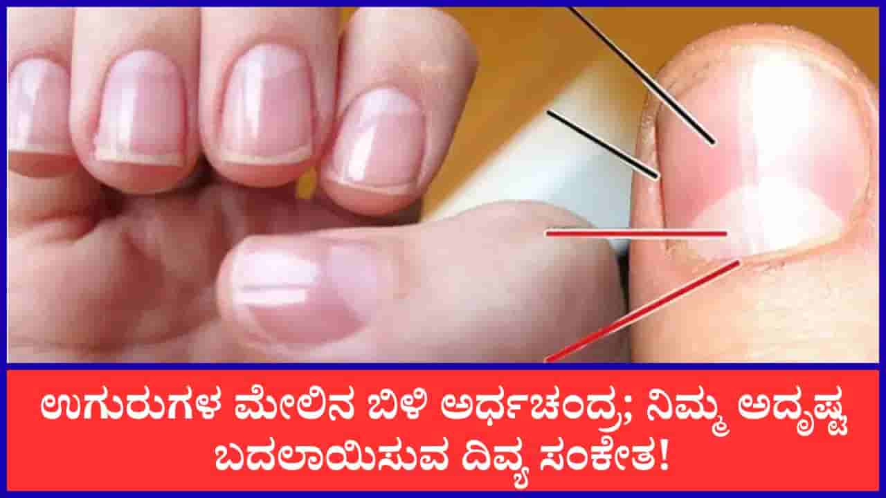 Samudrika Shastra: ನಿಮ್ಮ ಉಗುರುಗಳ ಮೇಲೆ ಬಿಳಿ ಅರ್ಧಚಂದ್ರಾಕೃತಿ ಇದೆಯೇ? ಈ ಬಗ್ಗೆ ಸಾಮುದ್ರಿಕ ಶಾಸ್ತ್ರ ಹೇಳುವುದೇನು ಗೊತ್ತಾ?