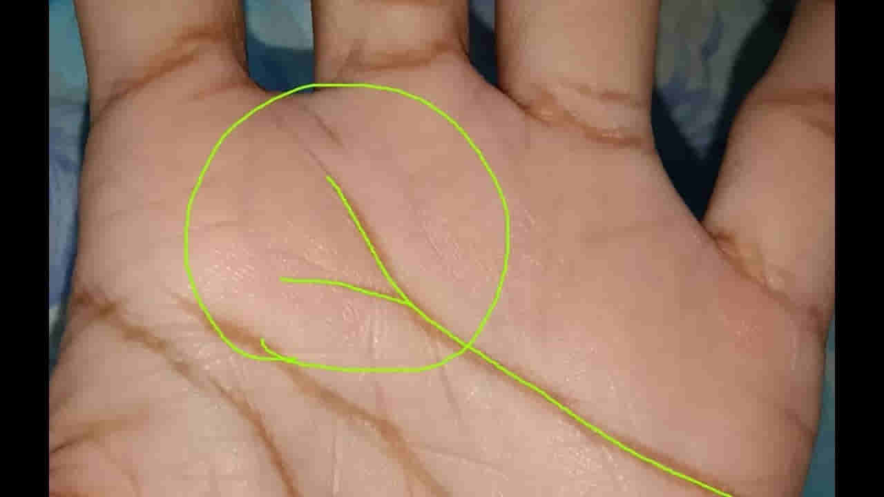 Palmistry: ಅಂಗೈಯಲ್ಲಿ V ಆಕಾರದ ರೇಖೆ ಇದೆಯೇ? ಹಾಗಿದ್ದರೆ ನಿಮ್ಮ ಭವಿಷ್ಯದಲ್ಲಿ ಕಾದಿದೆ ಅನಿರೀಕ್ಷಿತ ಅದೃಷ್ಟ!