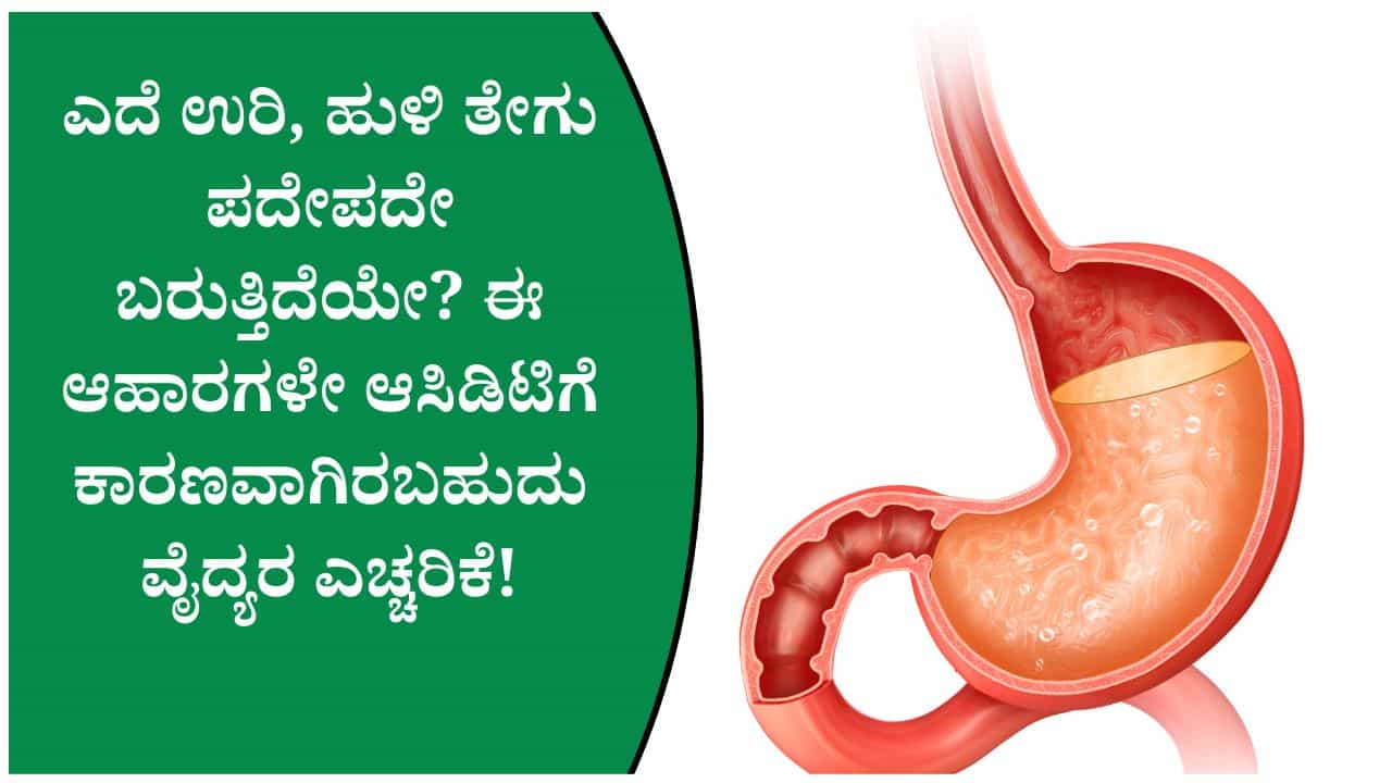 ಪದೇಪದೇ ಹುಳಿ ತೇಗು ಬರುತ್ತಿದ್ದರೆ ಈ ಆಹಾರಗಳ ಸೇವನೆಯನ್ನು ಕಡಿಮೆ ಮಾಡಿ