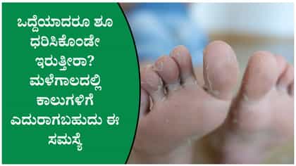 ಫಂಗಲ್ ಇನ್ಫೆಕ್ಷನ್‌ನಿಂದ ತಪ್ಪಿಸಿಕೊಳ್ಳಲು 4 ಟಿಪ್ಸ್