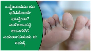 ಮಳೆಗಾಲದಲ್ಲಿ ಕಾಲುಗಳಲ್ಲಿ ಫಂಗಲ್ ಇನ್ಫೆಕ್ಷನ್ ಅಪಾಯ! ಈ 4 ತಪ್ಪುಗಳನ್ನು ಮಾಡಿದರೆ ಸಮಸ್ಯೆ ಹೆಚ್ಚಾಗಬಹುದು