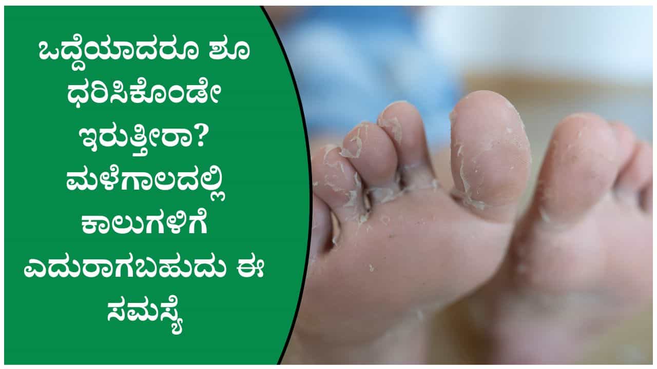 ಮಳೆಗಾಲದಲ್ಲಿ ಕಾಲುಗಳಲ್ಲಿ ಫಂಗಲ್ ಇನ್ಫೆಕ್ಷನ್ ಅಪಾಯ! ಈ 4 ತಪ್ಪುಗಳನ್ನು ಮಾಡಿದರೆ ಸಮಸ್ಯೆ ಹೆಚ್ಚಾಗಬಹುದು ಮಳೆಗಾಲದಲ್ಲಿ ಕಾಲುಗಳಲ್ಲಿ ಫಂಗಲ್ ಇನ್ಫೆಕ್ಷನ್ ಅಪಾಯ! ಈ 4 ತಪ್ಪುಗಳನ್ನು ಮಾಡಿದರೆ ಸಮಸ್ಯೆ ಹೆಚ್ಚಾಗಬಹುದು
