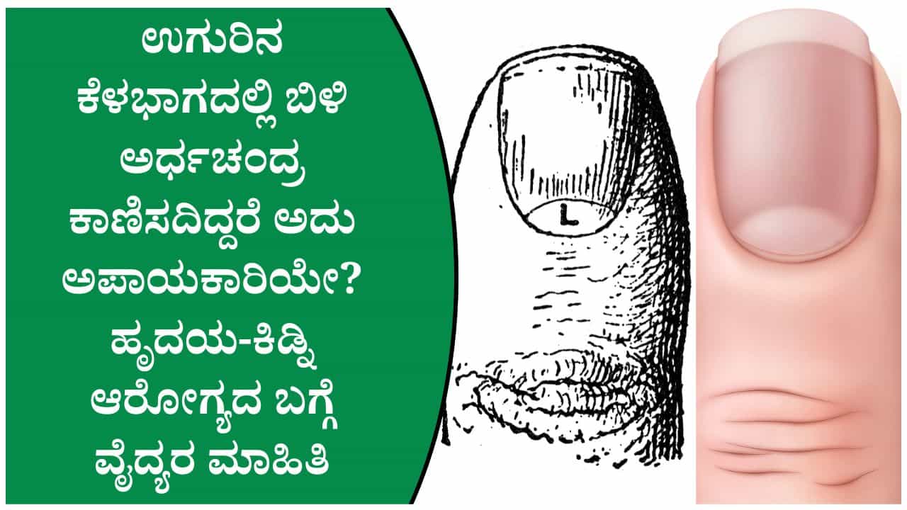 Heart-Kidney Health: ಉಗುರಿನ ಈ ಬಿಳಿ ಗುರುತು ನಿಮ್ಮ ಆರೋಗ್ಯದ ಬಗ್ಗೆ ಏನನ್ನು ಸೂಚಿಸುತ್ತದೆ? Heart-Kidney Health: ಉಗುರಿನ ಈ ಬಿಳಿ ಗುರುತು ನಿಮ್ಮ ಆರೋಗ್ಯದ ಬಗ್ಗೆ ಏನನ್ನು ಸೂಚಿಸುತ್ತದೆ?