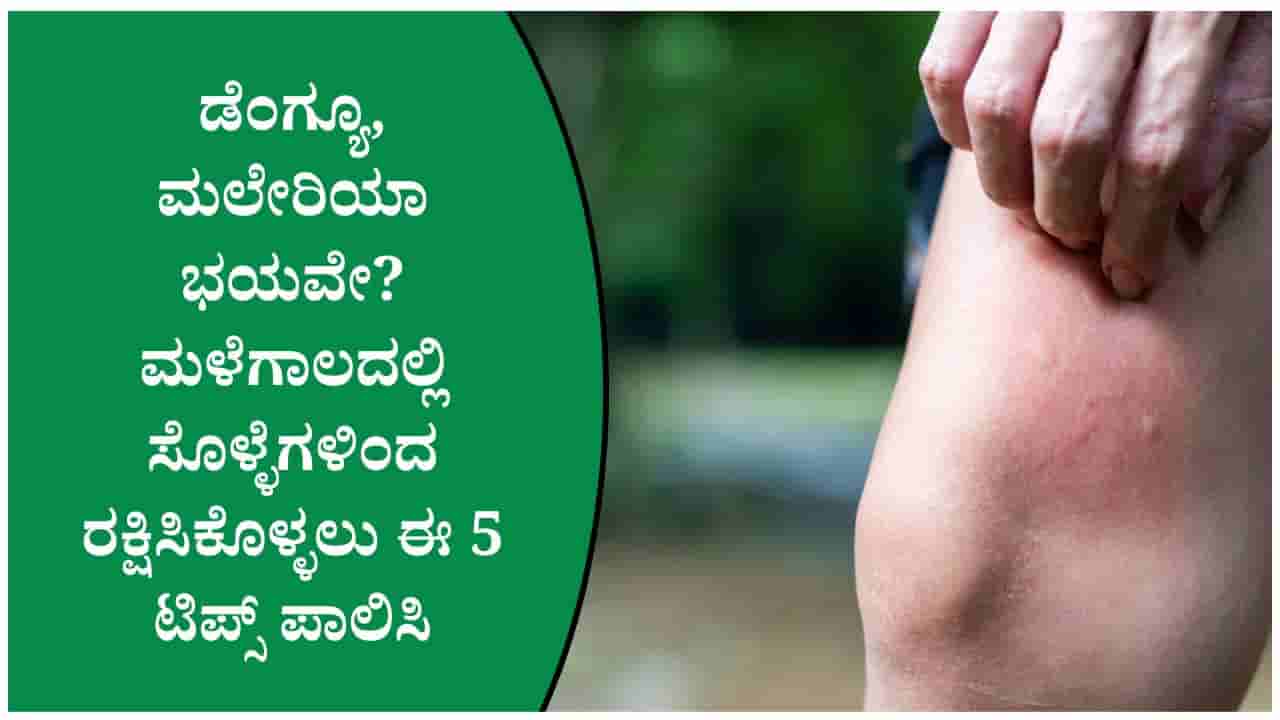 ಸೊಳ್ಳೆಗಳು ಬರದಂತೆ ತಡೆಯಲು ಈ 5 ನೈಸರ್ಗಿಕ ವಿಧಾನ ಟ್ರೈ ಮಾಡಿ