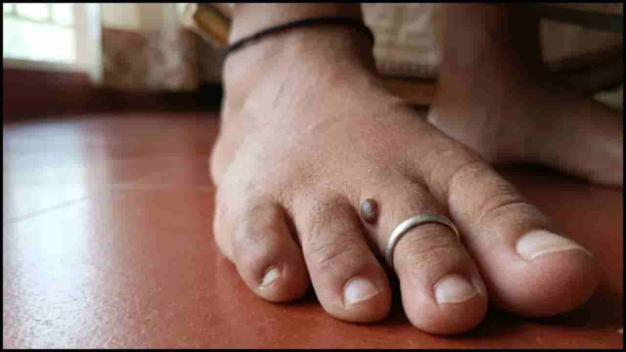 Samudrika Shastra: ಕಾಲ್ಬೆರಳುಗಳ ಮೇಲೆ ಮಚ್ಚೆ ಇದೆಯೇ? ಸಾಮುದ್ರಿಕ ಶಾಸ್ತ್ರದ ಆಸಕ್ತಿದಾಯಕ ರಹಸ್ಯ ತಿಳಿಯಿರಿ