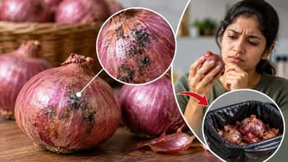 ಈರುಳ್ಳಿಯ ಮೇಲಿನ ಕಪ್ಪು ಕಲೆಗಳು ಏನು? ಇಂಥ ಈರುಳ್ಳಿ ತಿನ್ನಬಹುದೇ?