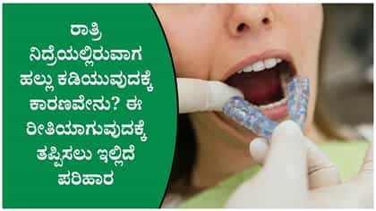 ನಿದ್ರೆಯಲ್ಲಿ ಹಲ್ಲು ಕಡಿಯುತ್ತಿದ್ದೀರಾ? ಈ ಲಕ್ಷಣ ಕಂಡರೆ ನಿರ್ಲಕ್ಷಿಸಬೇಡಿ!