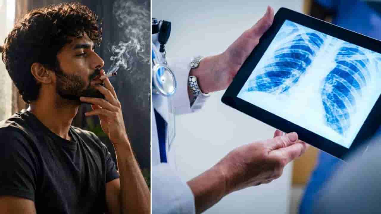 Smoking: ವರ್ಷಗಟ್ಟಲೆ ಧೂಮಪಾನ... ಹಾನಿಗೊಳಗಾದ ಶ್ವಾಸಕೋಶಗಳು ಹೇಗೆ ಚೇತರಿಸಿಕೊಳ್ಳಬಹುದು?