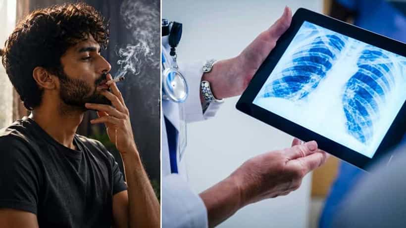 Smoking: ವರ್ಷಗಟ್ಟಲೆ ಧೂಮಪಾನ... ಹಾನಿಗೊಳಗಾದ ಶ್ವಾಸಕೋಶಗಳು ಹೇಗೆ ಚೇತರಿಸಿಕೊಳ್ಳಬಹುದು?