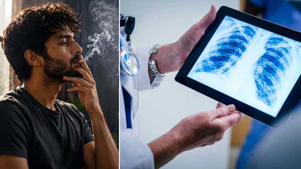Smoking: ವರ್ಷಗಟ್ಟಲೆ ಧೂಮಪಾನ... ಹಾನಿಗೊಳಗಾದ ಶ್ವಾಸಕೋಶಗಳು ಹೇಗೆ ಚೇತರಿಸಿಕೊಳ್ಳಬಹುದು? Smoking: ವರ್ಷಗಟ್ಟಲೆ ಧೂಮಪಾನ... ಹಾನಿಗೊಳಗಾದ ಶ್ವಾಸಕೋಶಗಳು ಹೇಗೆ ಚೇತರಿಸಿಕೊಳ್ಳಬಹುದು?
